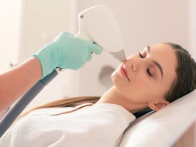 how to prepare for laser hair removal