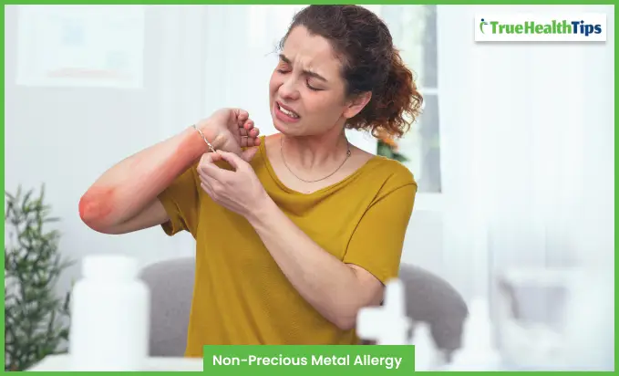 Non-Precious Metal Allergy