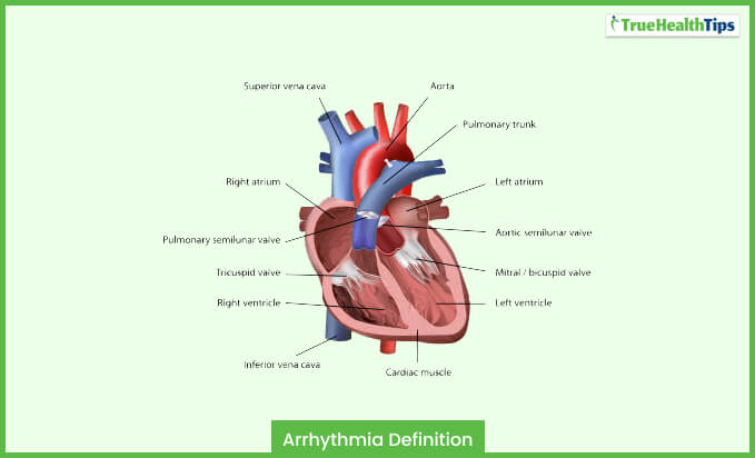 Arrhythmia Definition