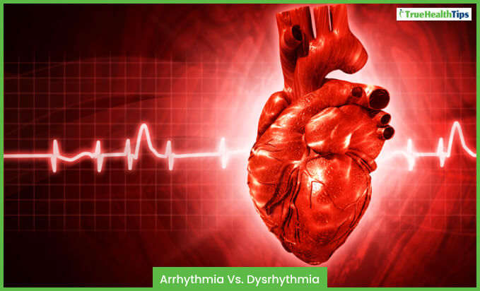 Arrhythmia VS. Dysrhythmia