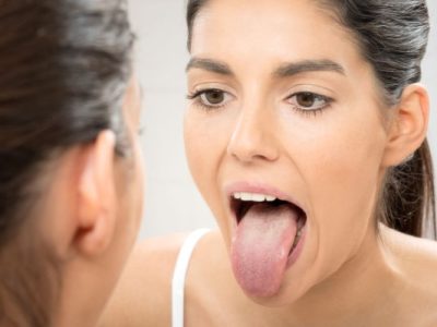how to get rid of adderall tongue