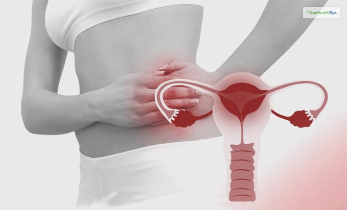 Pelvic Inflammatory Disease