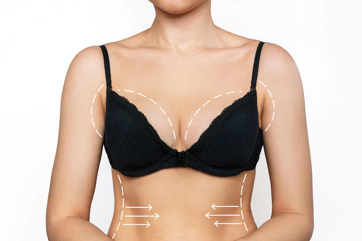 What is a Breast Lift