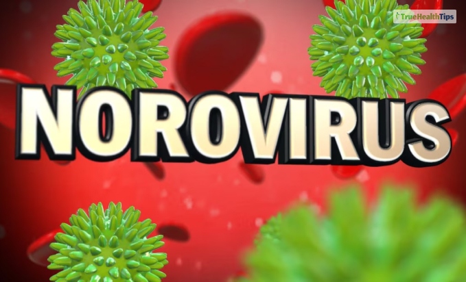 Norovirus Michigan Causes