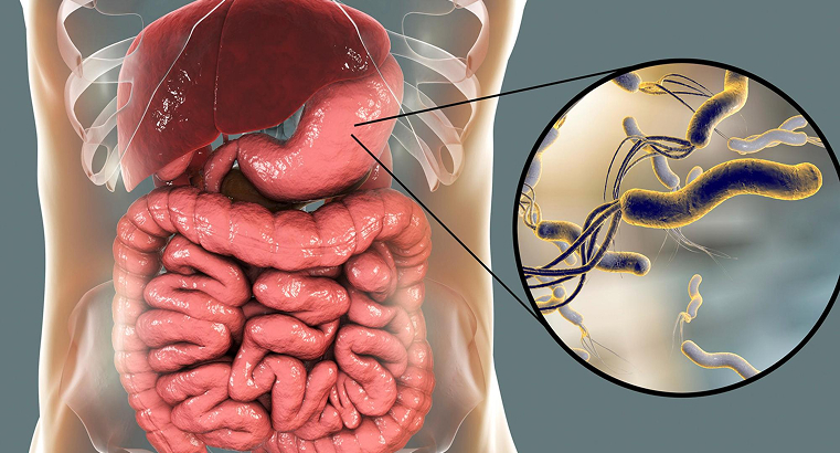 What Exactly Is A Stomach Bug
